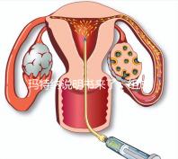 瑪特納說明書來了，組成成分、生產(chǎn)國家這都有