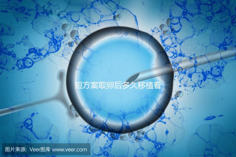 短方案取卵后多久移植看時(shí)機(jī)，關(guān)于試管你要知道一些事