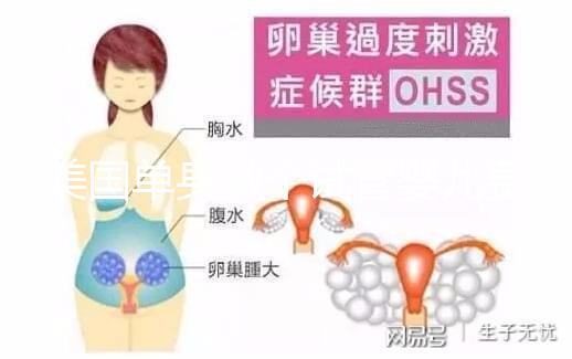 美國單身做個試管嬰兒費(fèi)用大概要多少?