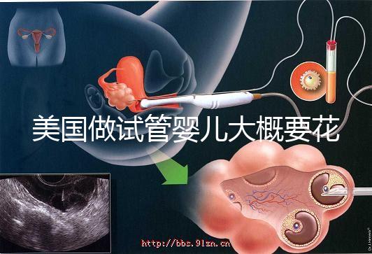 美國(guó)做試管嬰兒大概要花多少錢？具體支出25w！