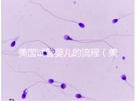 美國試管嬰兒的流程（美國試管嬰兒的流程是什么）