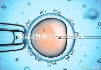 美國試管嬰兒安全可靠嗎？了解基本原理和安全性？