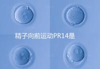精子向前運動PR14是否正常聽專家怎么說，當(dāng)心弱精找上門