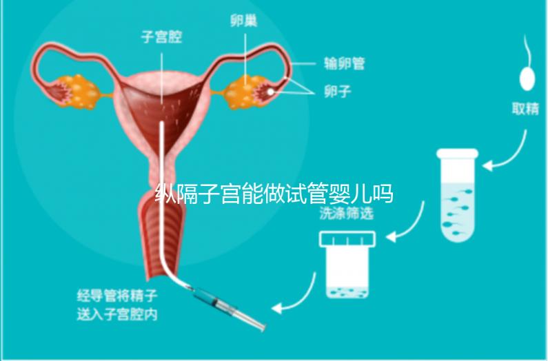 縱隔子宮能做試管嬰兒嗎?醫生:可以做，但要手術治療再進周