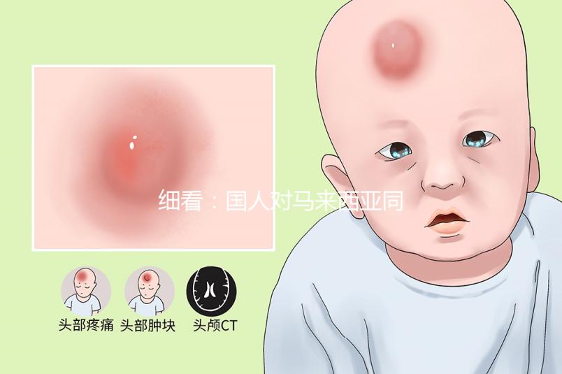 細看:國人對馬來西亞同善醫院試管嬰兒技術的評價