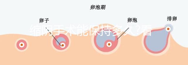 縮陰手術(shù)能保持多久?看看做過(guò)的人怎么說(shuō)