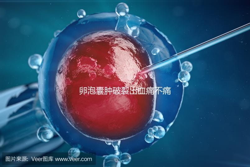 卵泡囊腫破裂出血痛不痛?經(jīng)歷過(guò)的姐妹們給出回應(yīng)