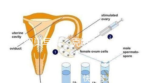 卵巢早衰，克齡蒙和芬嗎通藥物選擇引爭(zhēng)議