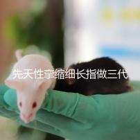 先天性攣縮細(xì)長指做三代試管嬰兒能避免遺傳嗎