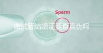 做試管結婚證要查真?zhèn)螁幔ㄗ鲈嚬芙Y婚證要查真?zhèn)螁岫嗌馘X）