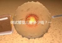 做試管嬰兒要多少錢？一起算筆經濟賬