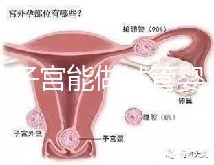 雙角子宮能做試管嬰兒?jiǎn)?？可以，但這2大條件缺一不可