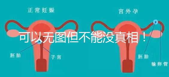 可以無圖但不能沒真相！段濤大夫帶你了解B超檢查報告單