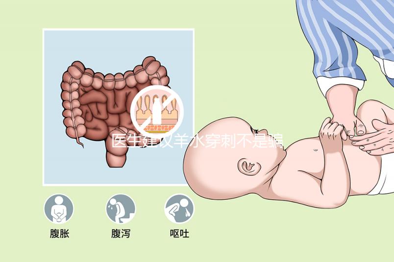 醫(yī)生建議羊水穿刺不是騙局,出現(xiàn)這些情況必須做