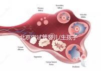 北京做試管嬰兒(生孩子)的費(fèi)用具體是多少？