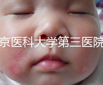 北京醫(yī)科大學(xué)第三醫(yī)院nt檢查費(fèi)用盤點(diǎn)需要多長時間,是否預(yù)約