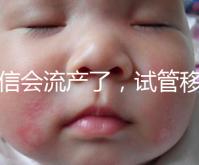 別信會流產了，試管移植后能不能吃胡椒粉聽我說！