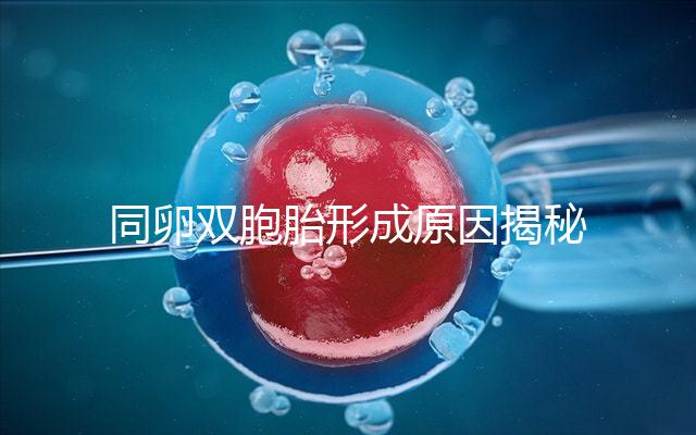 同卵雙胞胎形成原因揭秘，發育過程圖帶你弄清其中原理