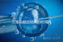 二維彩超出結果的時間并不長，從檢查流程便可看出