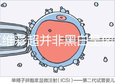 二維彩超并非黑白呈像，通過(guò)檢查還能看清胎兒五官