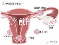 二胎臨產(chǎn)前的7大跡象，出現(xiàn)見紅、陣痛別大意