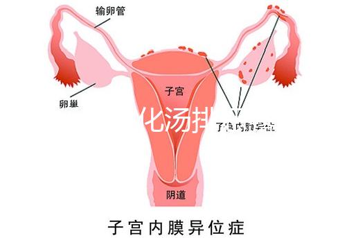 產后喝生化湯排惡露會使寶寶拉肚子？醫生：時間沒用對