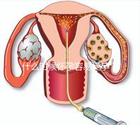 什么時候懷孕容易受孕？