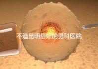 不造昆明最好的男科醫院是哪一家？中南醫院價格低了解下