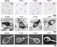 一文詳解超雄綜合癥概率有多大，想造的人多不多看過來