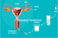 上海結婚落戶政策即將到來，包括2024年黃浦區詳細的戶籍流程