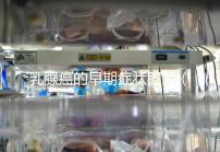 乳腺癌的早期癥狀圖片（乳頭瘤圖片+早期癥狀）