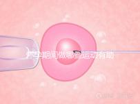 懷孕期間做哪些運動有助于自然分娩？