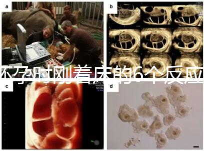 懷孕時剛著床的6個反應，同房后這個時候觀察身體最準