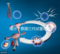 揭示了泰國三代試管成功率高的原因，以及優秀的技術 完美結合全方位服務