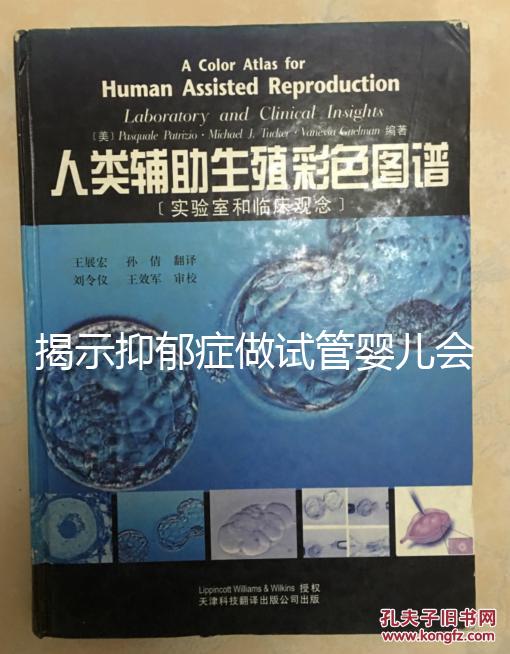 揭示抑郁癥做試管嬰兒會遺傳給女兒,想避免看這個