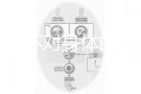 揭秘上環(huán)對身體的5大壞處，女人別再無知了