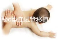 揭秘o型血試管移植凍囊胚費用，解凍+手術操作至少這個數