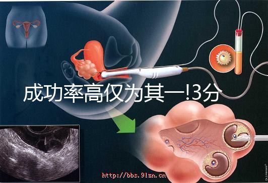 成功率高僅為其一!3分鐘看懂俄羅斯試管嬰兒的4大優勢