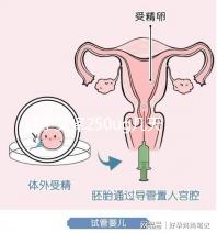 打了艾澤250ug幾天能代謝完戳，第十天別還不敢走下一步