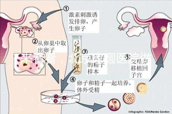 來看看，北京家圓醫院做三代試管費用總共多少？