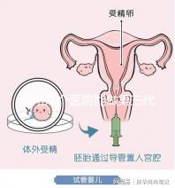 柳州幾個(gè)醫(yī)院能做第三代試管嬰兒？詳細(xì)的費(fèi)用成功率都在這