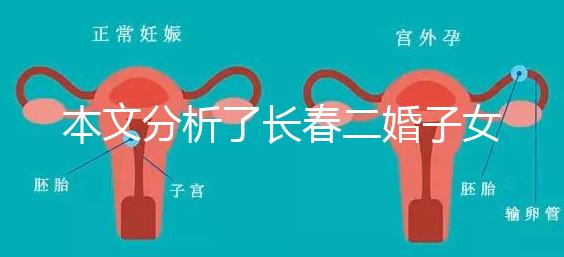 本文分析了長春二婚子女是否有補(bǔ)貼,每孩獎(jiǎng)勵(lì)1萬元,抓緊了解