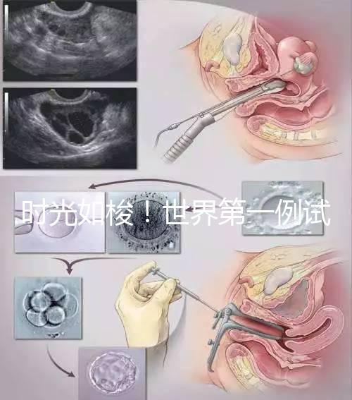 時光如梭！世界第一例試管嬰兒路易絲·布朗已經41歲啦