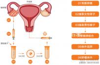 無性婚姻做試管嬰兒后來怎么樣？三個大案例揭開了內(nèi)幕