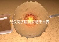 武漢同濟(jì)醫(yī)院采精手術(shù)費(fèi)用分析，顯微采精也可報(bào)銷(xiāo)