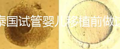 泰國(guó)試管嬰兒移植前做這3件事能提高成功率，不然會(huì)后悔！