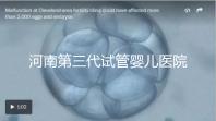 河南第三代試管嬰兒醫院整理，成功率、費用全在這
