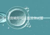 子宮畸形可以直接做試管嬰兒？醫(yī)生說(shuō)，應(yīng)先治療！