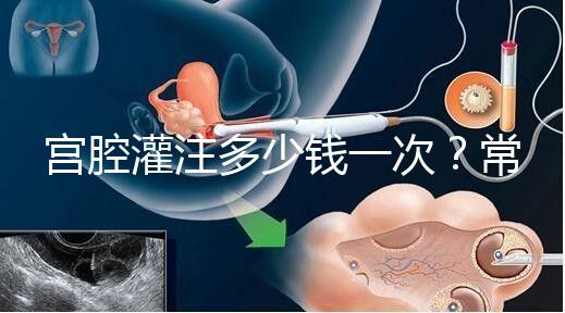 宮腔灌注多少錢一次？常見疑問匯總答疑
