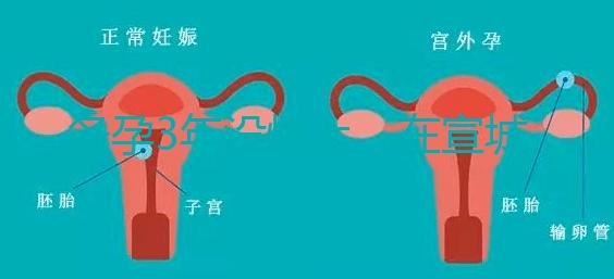 備孕3年沒懷上，在宣城可以做試管嬰兒嗎？